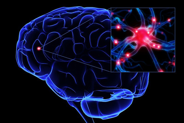 Imagem de uma ilustração do cérebro humano mostrando as áreas afetadas pelo mal de Alzheimer