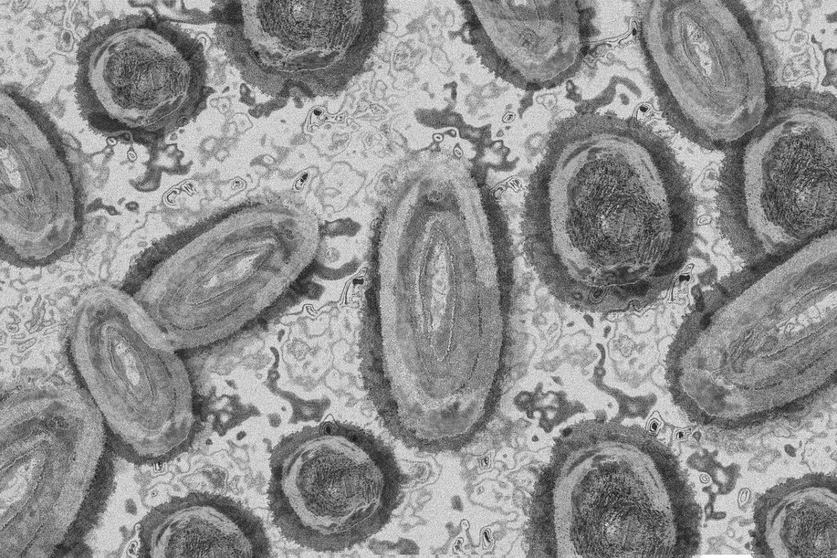 Representação microscópica em preto e branco das partículas virais da varíola do macaco