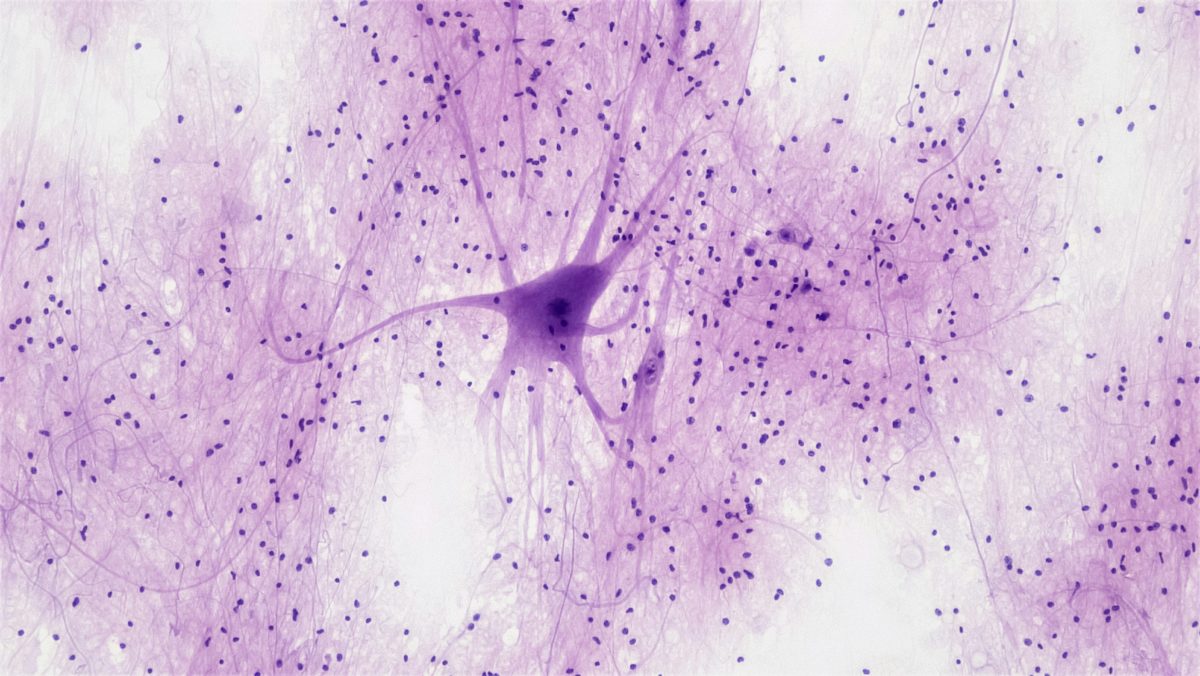 Imagem de neurônio roxo