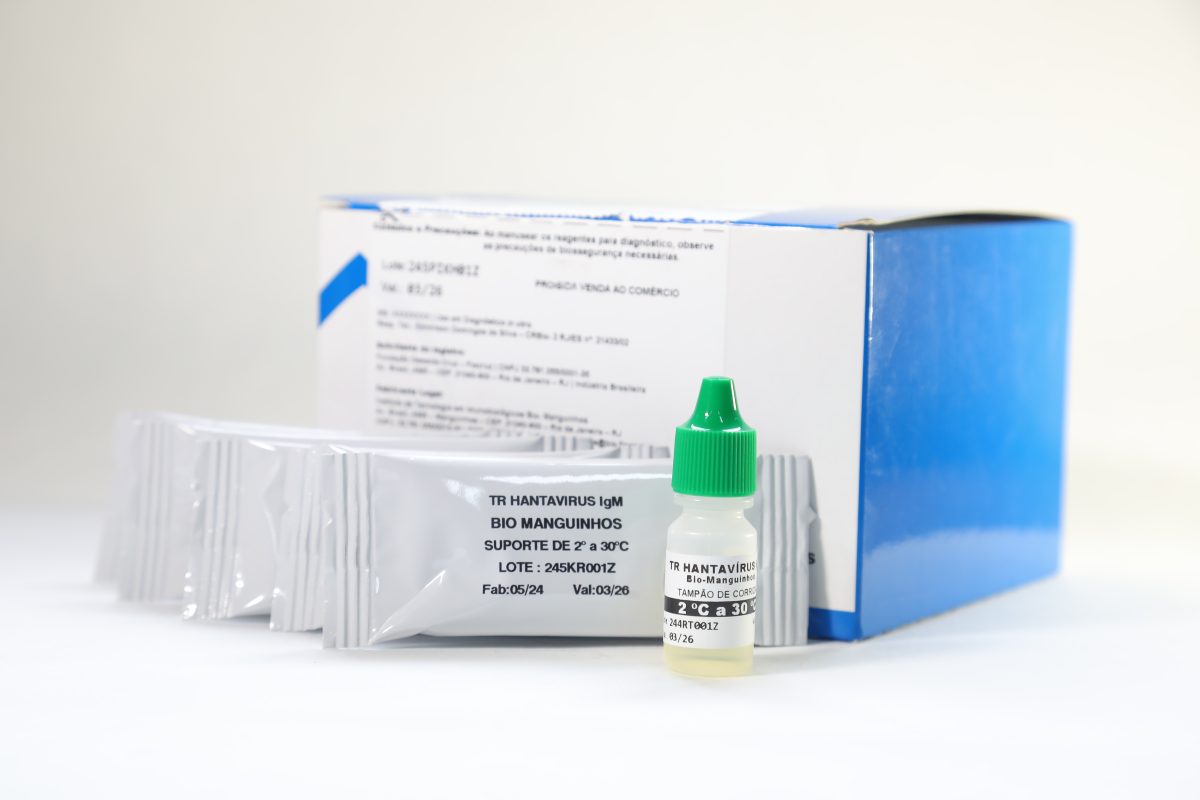 UFRJ e Fiocruz desenvolvem teste rápido para hantavirose